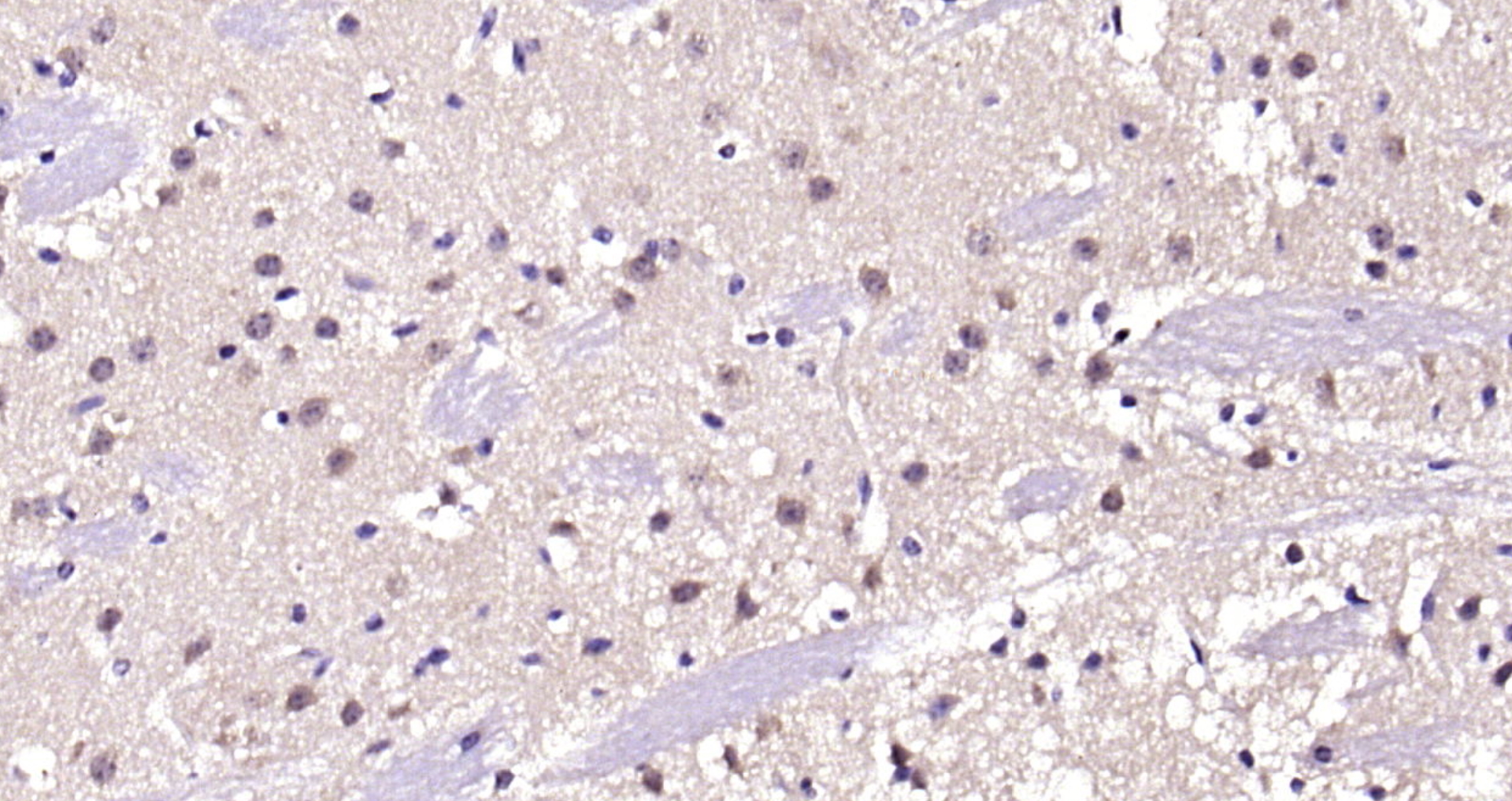 Paraformaldehyde-fixed, paraffin embedded (mouse brain); Antigen retrieval by boiling in sodium citrate buffer (pH6.0) for 15min; Block endogenous peroxidase by 3% hydrogen peroxide for 20 minutes; Blocking buffer (normal goat serum) at 37°C for 30min; Antibody incubation with (PP2A alpha + beta) Polyclonal Antibody, Unconjugated (bs-0029R) at 1:200 overnight at 4°C, followed by operating according to SP Kit(Rabbit) (sp-0023) instructionsand DAB staining.