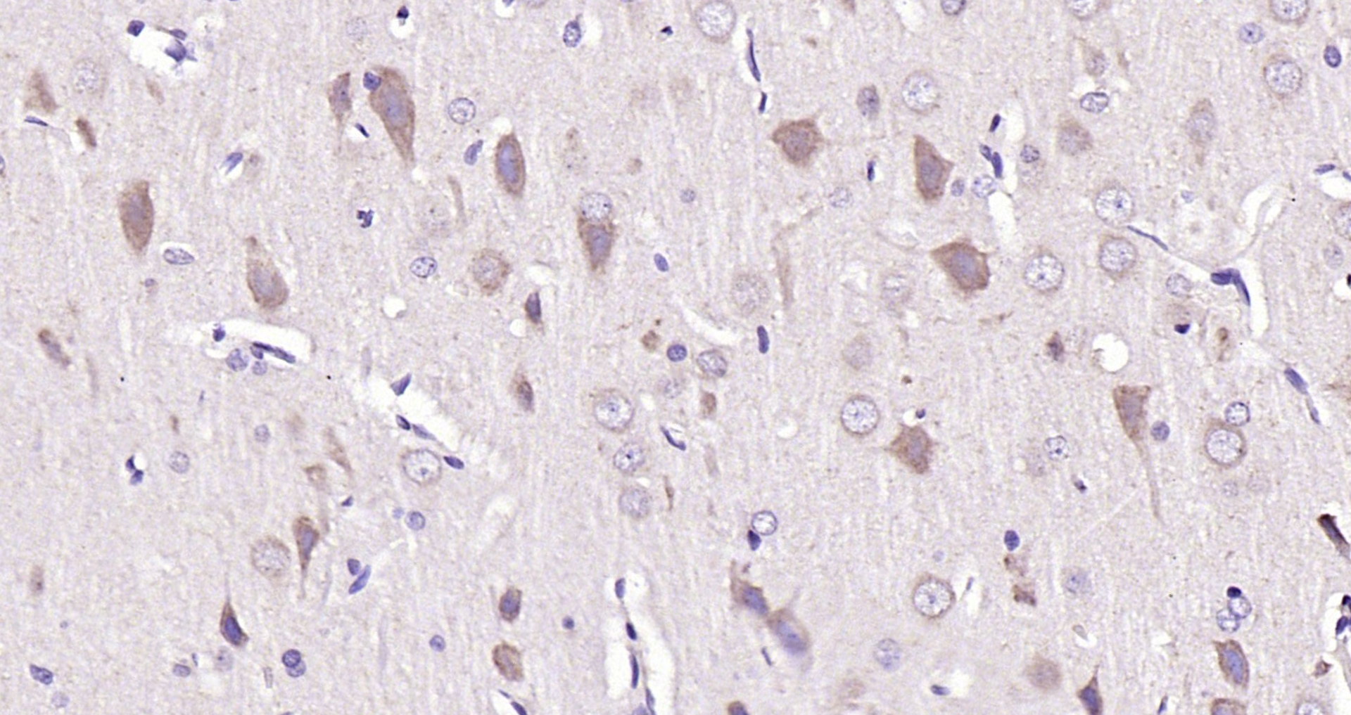 Paraformaldehyde-fixed, paraffin embedded (rat brain); Antigen retrieval by boiling in sodium citrate buffer (pH6.0) for 15min; Block endogenous peroxidase by 3% hydrogen peroxide for 20 minutes; Blocking buffer (normal goat serum) at 37°C for 30min; Antibody incubation with (SFRP1) Polyclonal Antibody, Unconjugated (bs-1303R) at 1:200 overnight at 4°C, followed by operating according to SP Kit(Rabbit) (sp-0023) instructionsand DAB staining.