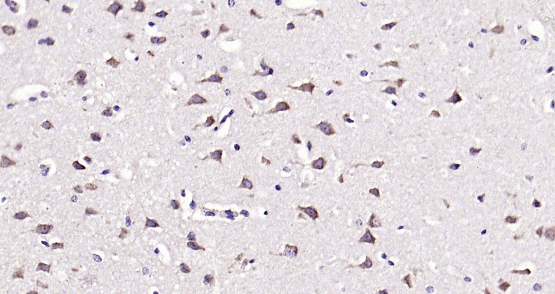 Paraformaldehyde-fixed, paraffin embedded (mouse brain); Antigen retrieval by boiling in sodium citrate buffer (pH6.0) for 15min; Block endogenous peroxidase by 3% hydrogen peroxide for 20 minutes; Blocking buffer (normal goat serum) at 37°C for 30min; Antibody incubation with (SFRP1) Polyclonal Antibody, Unconjugated (bs-1303R) at 1:200 overnight at 4°C, followed by operating according to SP Kit(Rabbit) (sp-0023) instructionsand DAB staining.