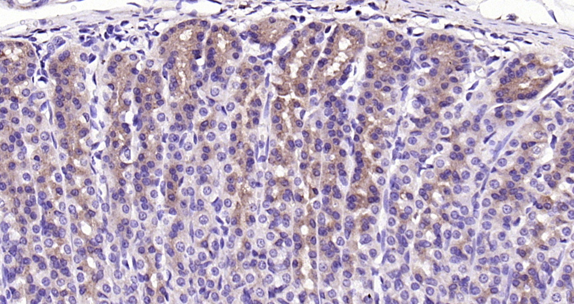 Paraformaldehyde-fixed, paraffin embedded (rat stomach); Antigen retrieval by boiling in sodium citrate buffer (pH6.0) for 15min; Block endogenous peroxidase by 3% hydrogen peroxide for 20 minutes; Blocking buffer (normal goat serum) at 37°C for 30min; Antibody incubation with (SFRP1) Polyclonal Antibody, Unconjugated (bs-1303R) at 1:200 overnight at 4°C, followed by operating according to SP Kit(Rabbit) (sp-0023) instructionsand DAB staining.