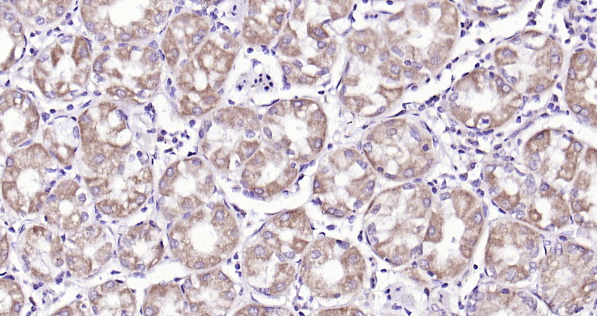 Paraformaldehyde-fixed, paraffin embedded (human stomach); Antigen retrieval by boiling in sodium citrate buffer (pH6.0) for 15min; Block endogenous peroxidase by 3% hydrogen peroxide for 20 minutes; Blocking buffer (normal goat serum) at 37°C for 30min; Antibody incubation with (SFRP1) Polyclonal Antibody, Unconjugated (bs-1303R) at 1:200 overnight at 4°C, followed by operating according to SP Kit(Rabbit) (sp-0023) instructionsand DAB staining.