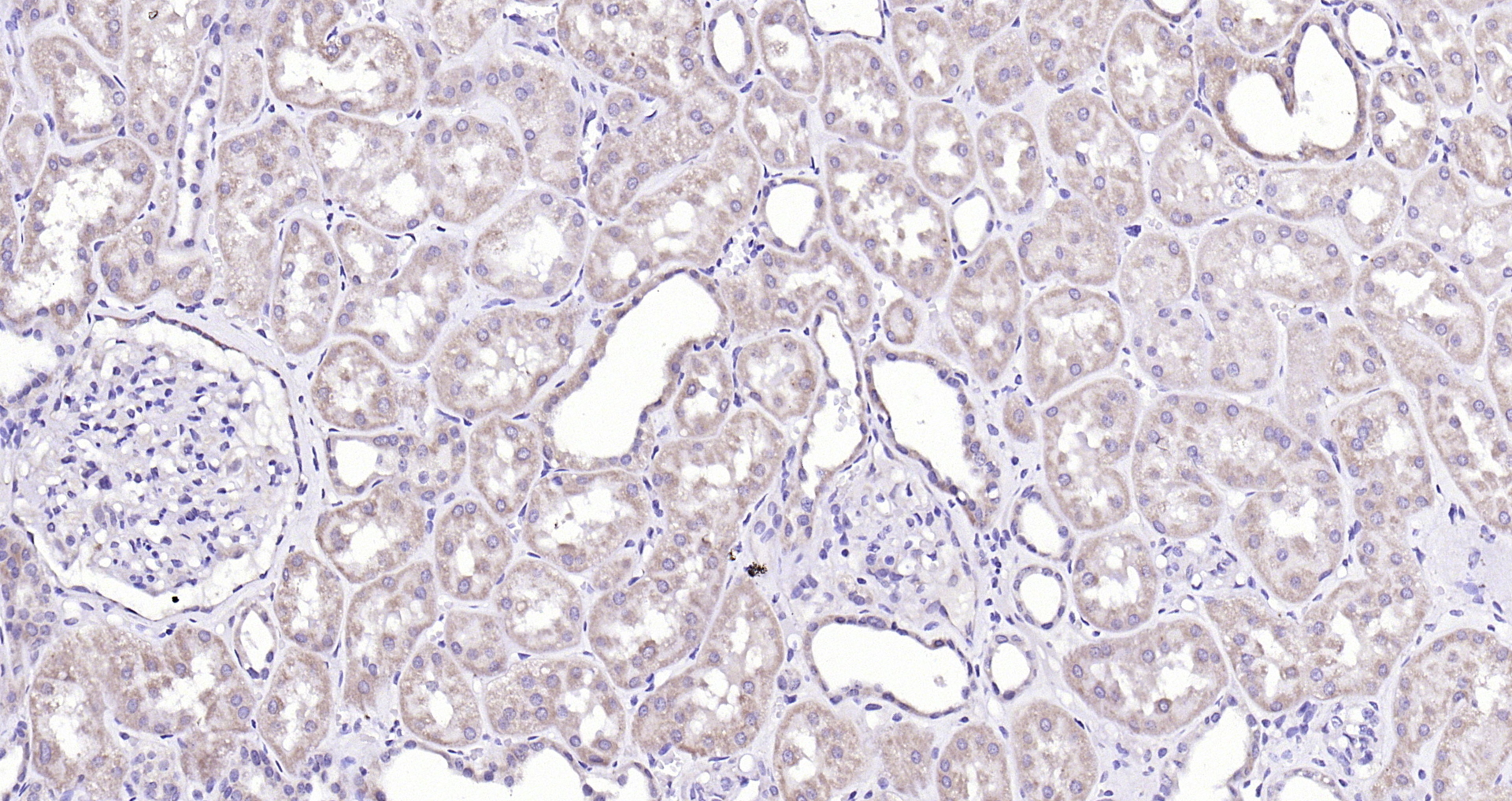 Paraformaldehyde-fixed, paraffin embedded (human kidney); Antigen retrieval by boiling in sodium citrate buffer (pH6.0) for 15min; Block endogenous peroxidase by 3% hydrogen peroxide for 20 minutes; Blocking buffer (normal goat serum) at 37°C for 30min; Antibody incubation with (SFRP1) Polyclonal Antibody, Unconjugated (bs-1303R) at 1:200 overnight at 4°C, followed by operating according to SP Kit(Rabbit) (sp-0023) instructionsand DAB staining.