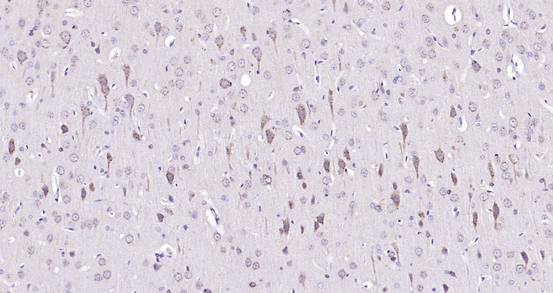 Paraformaldehyde-fixed, paraffin embedded (rat brain); Antigen retrieval by boiling in sodium citrate buffer (pH6.0) for 15min; Block endogenous peroxidase by 3% hydrogen peroxide for 20 minutes; Blocking buffer (normal goat serum) at 37°C for 30min; Antibody incubation with (TPA) Polyclonal Antibody, Unconjugated (bs-1545R) at 1:200 overnight at 4°C, followed by operating according to SP Kit(Rabbit) (sp-0023) instructionsand DAB staining.