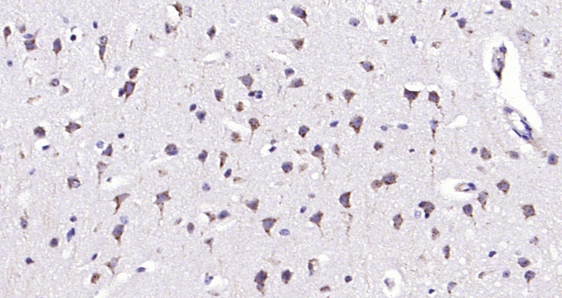 Paraformaldehyde-fixed, paraffin embedded (mouse brain); Antigen retrieval by boiling in sodium citrate buffer (pH6.0) for 15min; Block endogenous peroxidase by 3% hydrogen peroxide for 20 minutes; Blocking buffer (normal goat serum) at 37°C for 30min; Antibody incubation with (TPA) Polyclonal Antibody, Unconjugated (bs-1545R) at 1:200 overnight at 4°C, followed by operating according to SP Kit(Rabbit) (sp-0023) instructionsand DAB staining.