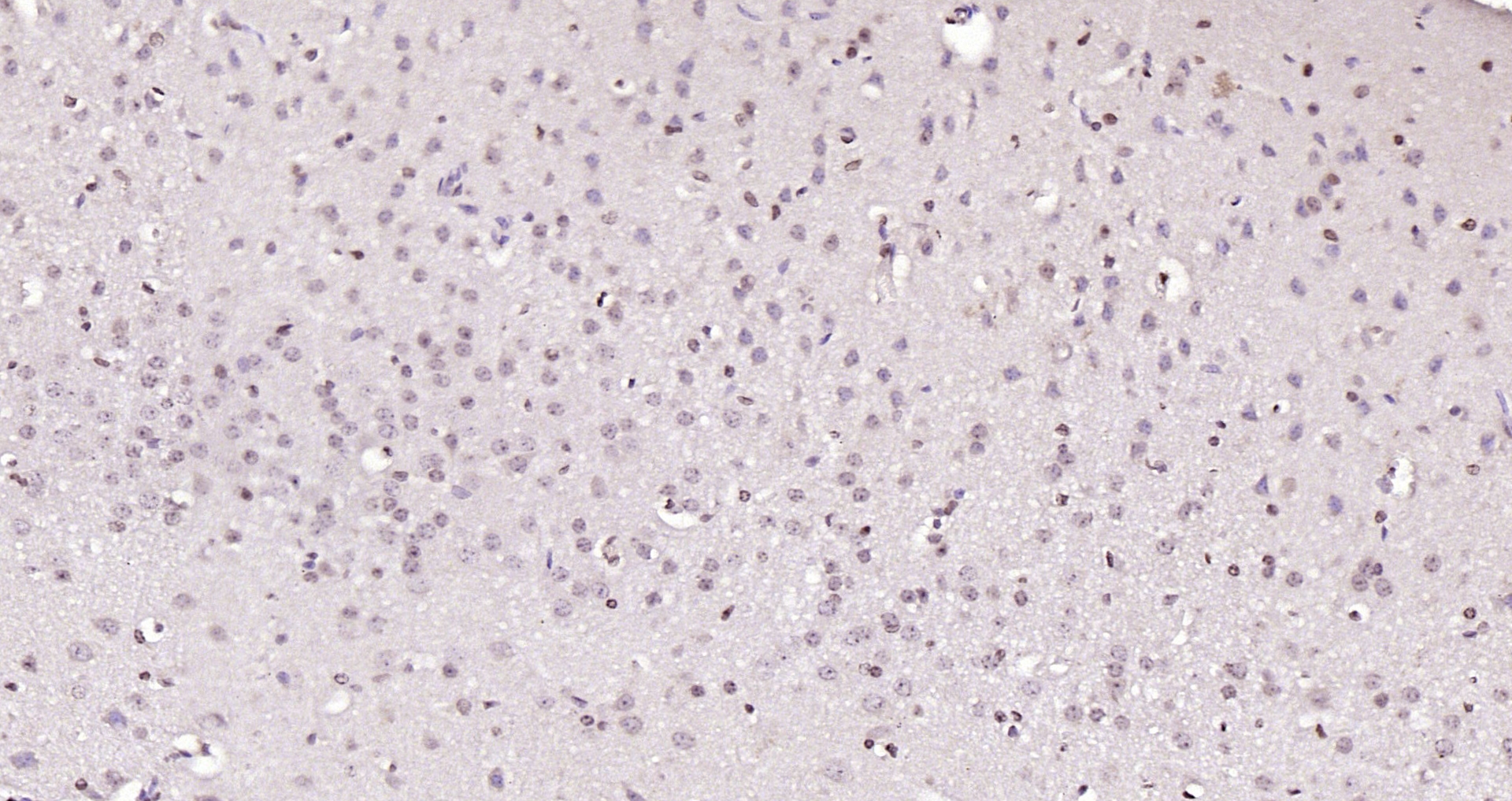 Paraformaldehyde-fixed, paraffin embedded (mouse brain); Antigen retrieval by boiling in sodium citrate buffer (pH6.0) for 15min; Block endogenous peroxidase by 3% hydrogen peroxide for 20 minutes; Blocking buffer (normal goat serum) at 37°C for 30min; Antibody incubation with (HDAC3/HD3) Polyclonal Antibody, Unconjugated (bs-10024R) at 1:200 overnight at 4°C, followed by operating according to SP Kit(Rabbit) (sp-0023) instructionsand DAB staining.
