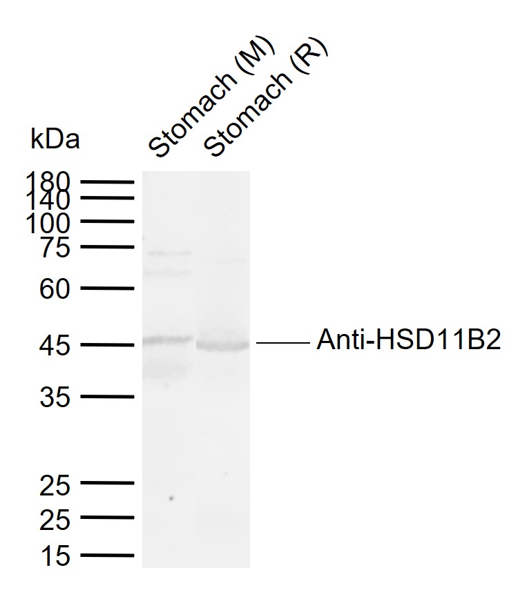 Lane 1: Mouse Stomach tissue lysates; Lane 2: Rat Stomach tissue lysates probed with HSD11B2 Polyclonal Antibody, Unconjugated (bs-3618R) at 1:1000 dilution and 4°C overnight incubation. Followed by conjugated secondary antibody incubation at 1:20000 for 60 min at 37˚C. Lane 1: Mouse Stomach tissue lysates; Lane 2: Rat Stomach tissue lysates probed with HSD11B2 Polyclonal Antibody, Unconjugated (bs-3618R) at 1:1000 dilution and 4°C overnight incubation. Followed by conjugated secondary antibody incubation at 1:20000 for 60 min at 37˚C.