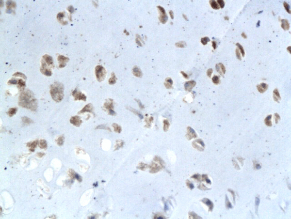 Formalin-fixed and paraffin embedded rat intervertebral disk labeled with Anti-ELASTIN, Unconjugated(bs-1756R) followed by conjugation to the secondary antibody and DAB staining