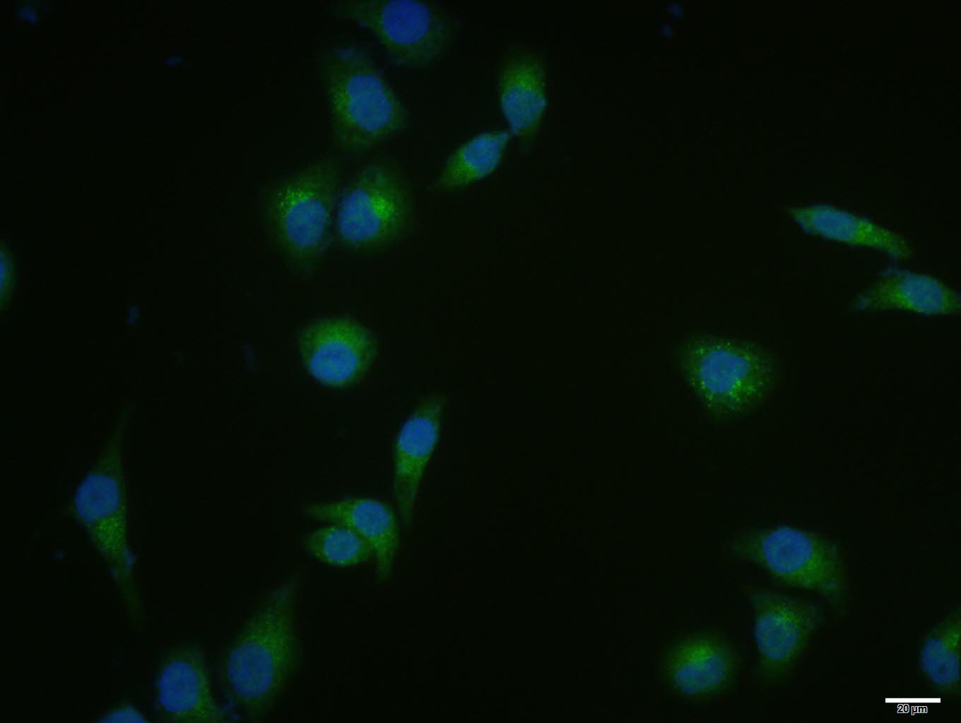 Hela cell; 4% Paraformaldehyde-fixed; Triton X-100 at room temperature for 20 min; Blocking buffer (normal goat serum, C-0005) at 37°C for 20 min; Antibody incubation with (DICER1) polyclonal Antibody, Unconjugated (bs-6697R) 1:100, 90 minutes at 37°C; followed by a conjugated Goat Anti-Rabbit IgG antibody at 37°C for 90 minutes, DAPI (blue, C02-04002) was used to stain the cell nuclei.