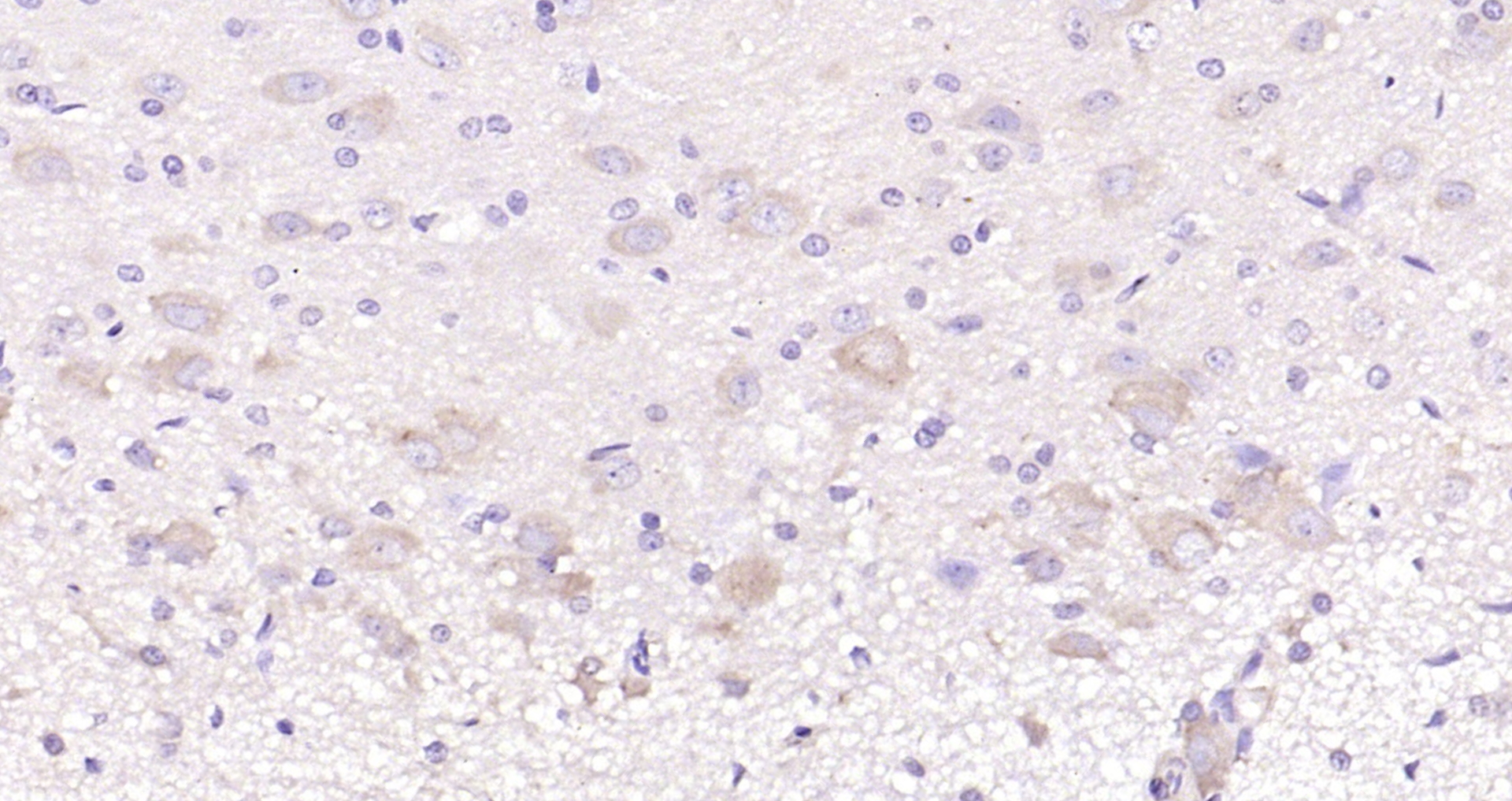 Paraformaldehyde-fixed, paraffin embedded (rat brain); Antigen retrieval by boiling in sodium citrate buffer (pH6.0) for 15min; Block endogenous peroxidase by 3% hydrogen peroxide for 20 minutes; Blocking buffer (normal goat serum) at 37°C for 30min; Antibody incubation with (GHRH) Polyclonal Antibody, Unconjugated (bs-0205R) at 1:200 overnight at 4°C, followed by operating according to SP Kit(Rabbit) (sp-0023) instructionsand DAB staining.