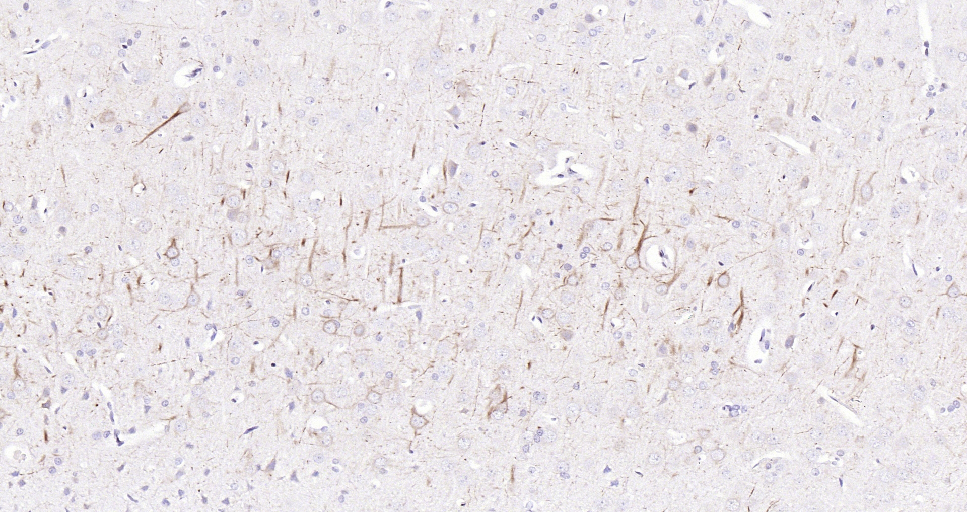 Paraformaldehyde-fixed, paraffin embedded (rat brain); Antigen retrieval by boiling in sodium citrate buffer (pH6.0) for 15min; Block endogenous peroxidase by 3% hydrogen peroxide for 20 minutes; Blocking buffer (normal goat serum) at 37°C for 30min; Antibody incubation with (NF-H) Polyclonal Antibody, Unconjugated (bs-0708R) at 1:200 overnight at 4°C, followed by operating according to SP Kit(Rabbit) (sp-0023) instructionsand DAB staining.