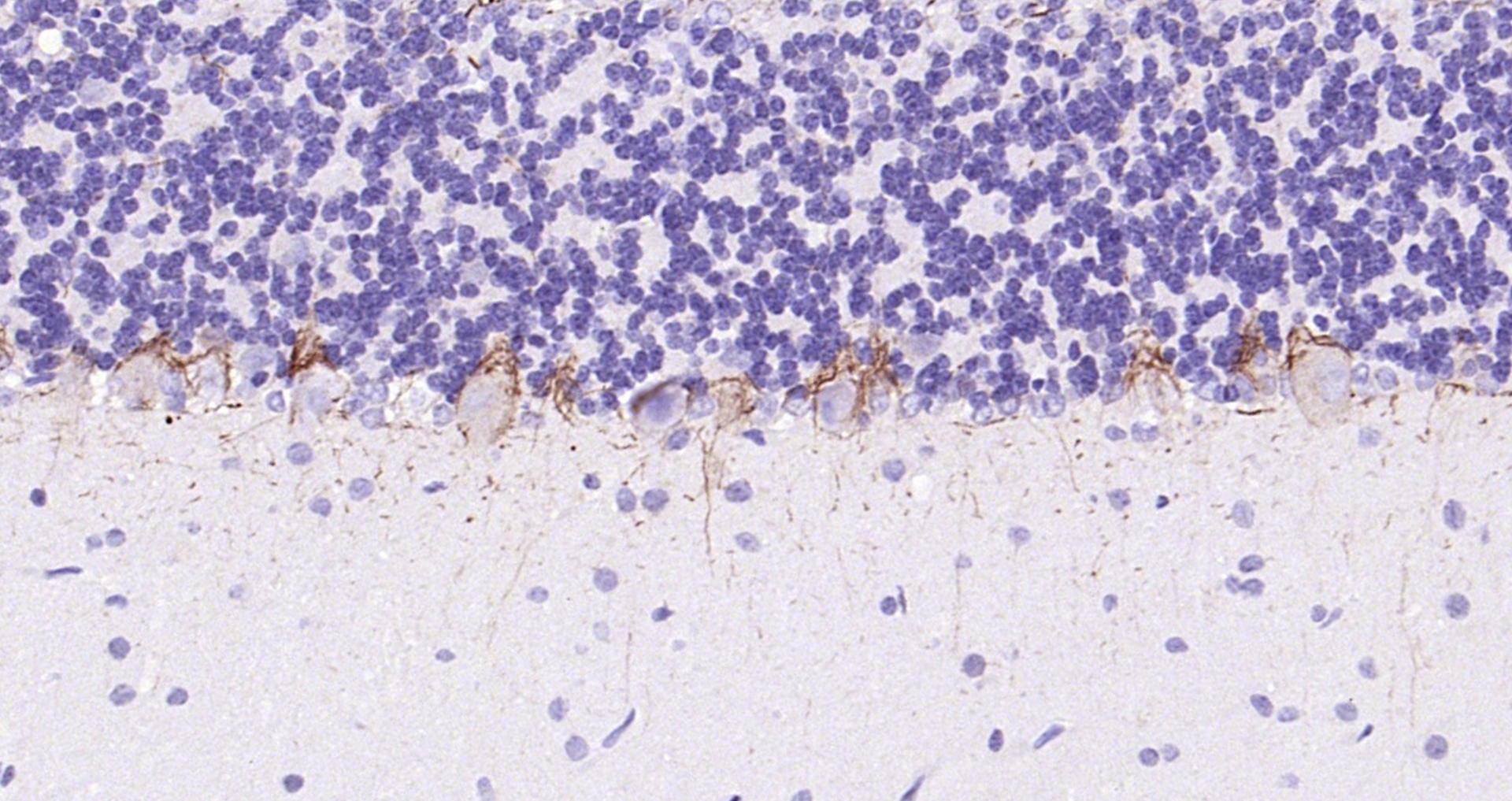 Paraformaldehyde-fixed, paraffin embedded (rat cerebellum); Antigen retrieval by boiling in sodium citrate buffer (pH6.0) for 15min; Block endogenous peroxidase by 3% hydrogen peroxide for 20 minutes; Blocking buffer (normal goat serum) at 37°C for 30min; Antibody incubation with (NF-H) Polyclonal Antibody, Unconjugated (bs-0708R) at 1:200 overnight at 4°C, followed by operating according to SP Kit(Rabbit) (sp-0023) instructionsand DAB staining.