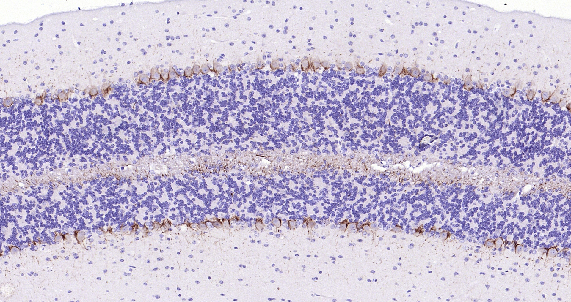 Paraformaldehyde-fixed, paraffin embedded (mouse cerebellum); Antigen retrieval by boiling in sodium citrate buffer (pH6.0) for 15min; Block endogenous peroxidase by 3% hydrogen peroxide for 20 minutes; Blocking buffer (normal goat serum) at 37°C for 30min; Antibody incubation with (NF-H) Polyclonal Antibody, Unconjugated (bs-0708R) at 1:200 overnight at 4°C, followed by operating according to SP Kit(Rabbit) (sp-0023) instructionsand DAB staining.