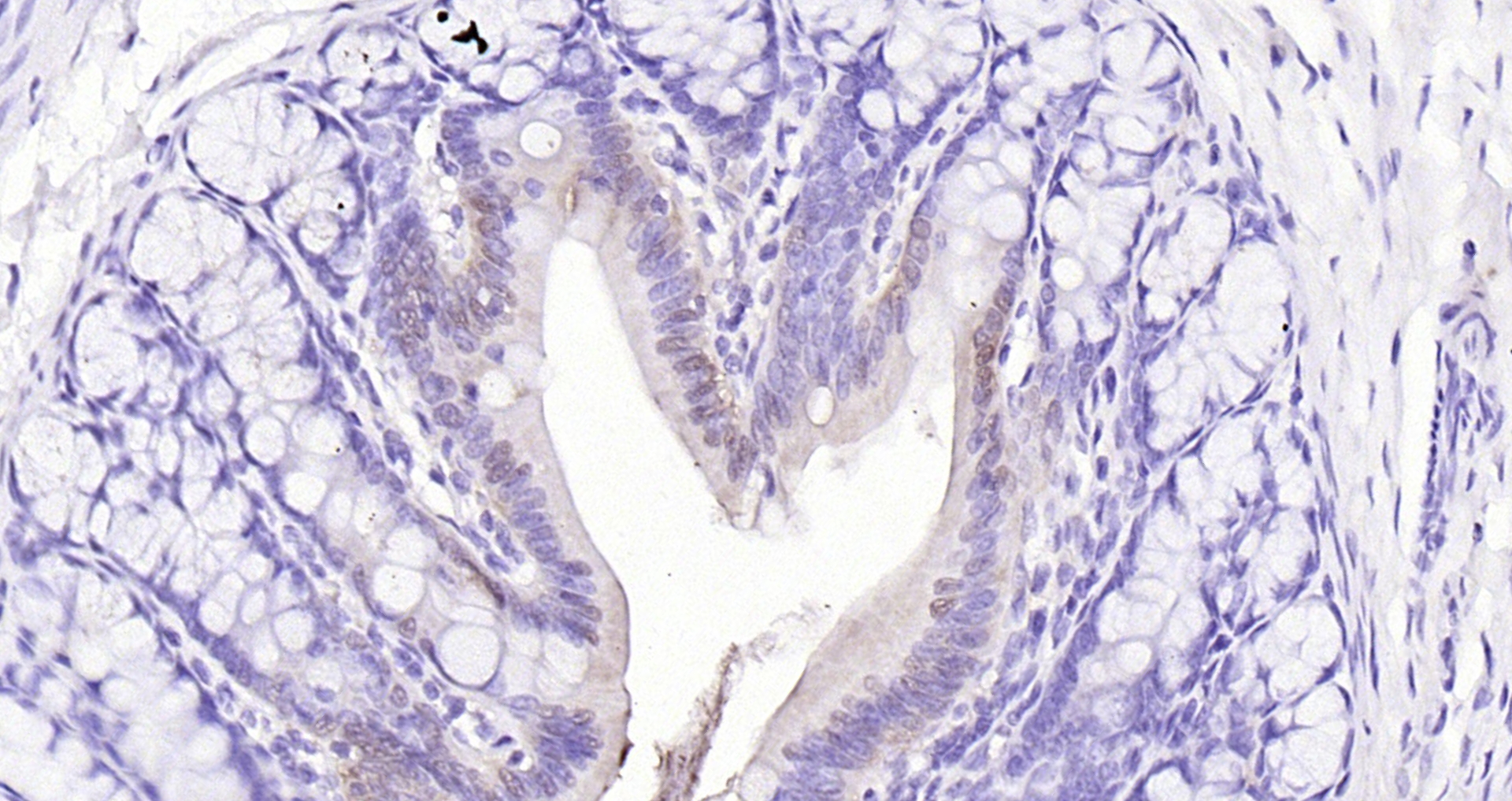 Paraformaldehyde-fixed, paraffin embedded (rat colon); Antigen retrieval by boiling in sodium citrate buffer (pH6.0) for 15min; Block endogenous peroxidase by 3% hydrogen peroxide for 20 minutes; Blocking buffer (normal goat serum) at 37°C for 30min; Antibody incubation with (FAF1) Polyclonal Antibody, Unconjugated (bs-1348R) at 1:200 overnight at 4°C, followed by operating according to SP Kit(Rabbit) (sp-0023) instructionsand DAB staining.