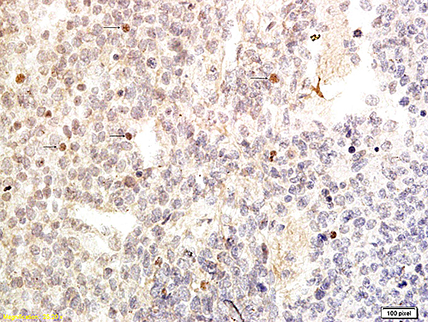 Formalin-fixed and paraffin embedded human embryonic cells labeled with Anti-GATA-4, Unconjugated (bs-1778R) followed by conjugation to the secondary antibody and DAB staining
