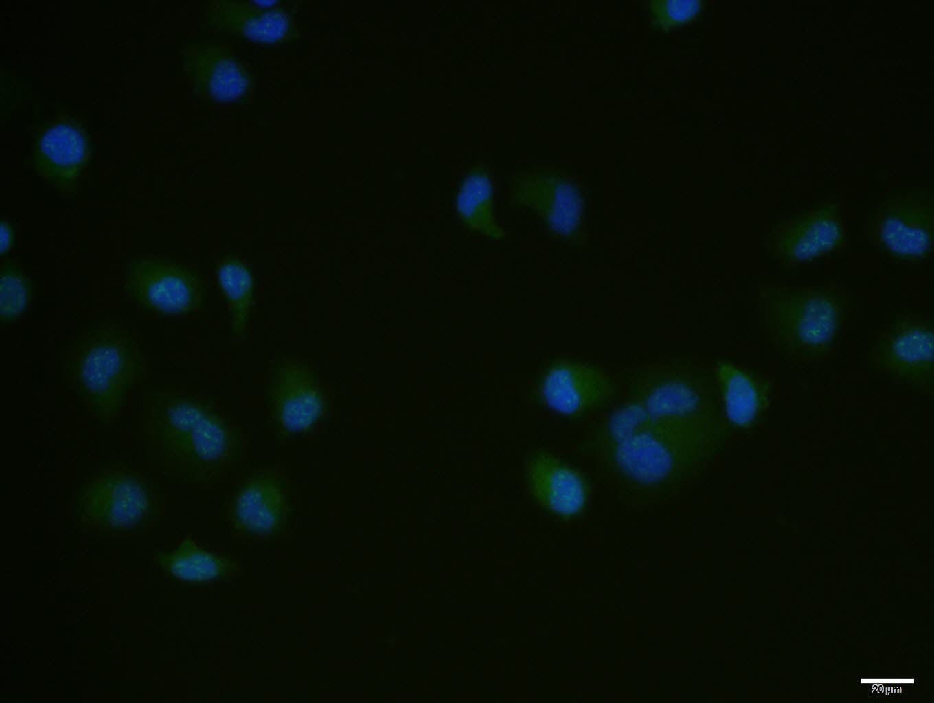 Hela cell; 4% Paraformaldehyde-fixed; Triton X-100 at room temperature for 20 min; Blocking buffer (normal goat serum, C-0005) at 37°C for 20 min; Antibody incubation with (Bcl-2) polyclonal Antibody, Unconjugated (bs-4563R) 1:100, 90 minutes at 37°C; followed by a conjugated Goat Anti-Rabbit IgG antibody at 37°C for 90 minutes, DAPI (blue, C02-04002) was used to stain the cell nuclei.