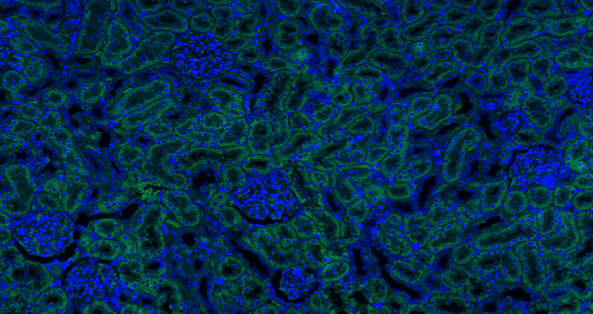 Paraformaldehyde-fixed, paraffin embedded (rat kidney); Antigen retrieval by boiling in sodium citrate buffer (pH6.0) for 15min; Blocking buffer (normal goat serum) at 37°C for 30min; Antibody incubation with (APG5L) Polyclonal Antibody, Unconjugated (bs-4005R) at 1:200 overnight at 4°C, followed by a conjugated Goat Anti-rabbit IgG antibody (bs-0295G-AF488) for 90 minutes, and DAPI for nuclei staining.