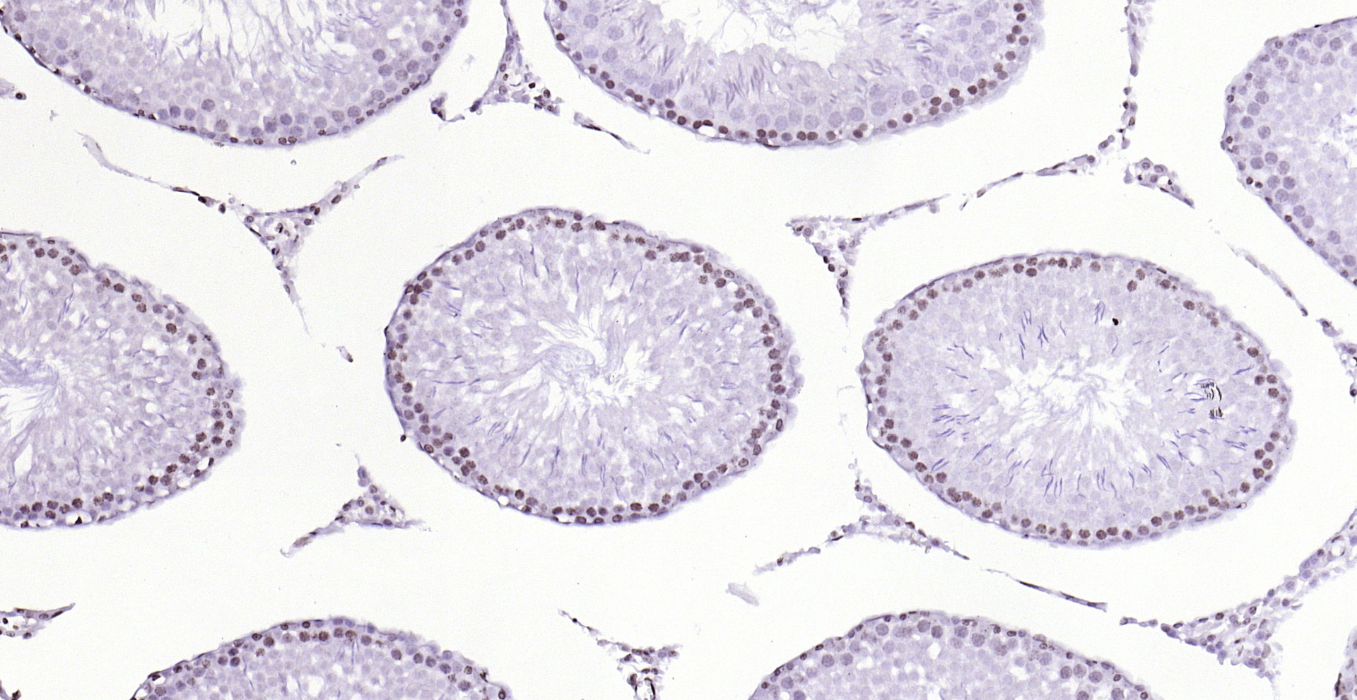 Paraformaldehyde-fixed, paraffin embedded (rat testis); Antigen retrieval by boiling in sodium citrate buffer (pH6.0) for 15min; Block endogenous peroxidase by 3% hydrogen peroxide for 20 minutes; Blocking buffer (normal goat serum) at 37°C for 30min; Antibody incubation with (PEG3) Polyclonal Antibody, Unconjugated (bs-1870R) at 1:200 overnight at 4°C, followed by operating according to SP Kit(Rabbit) (sp-0023) instructionsand DAB staining.