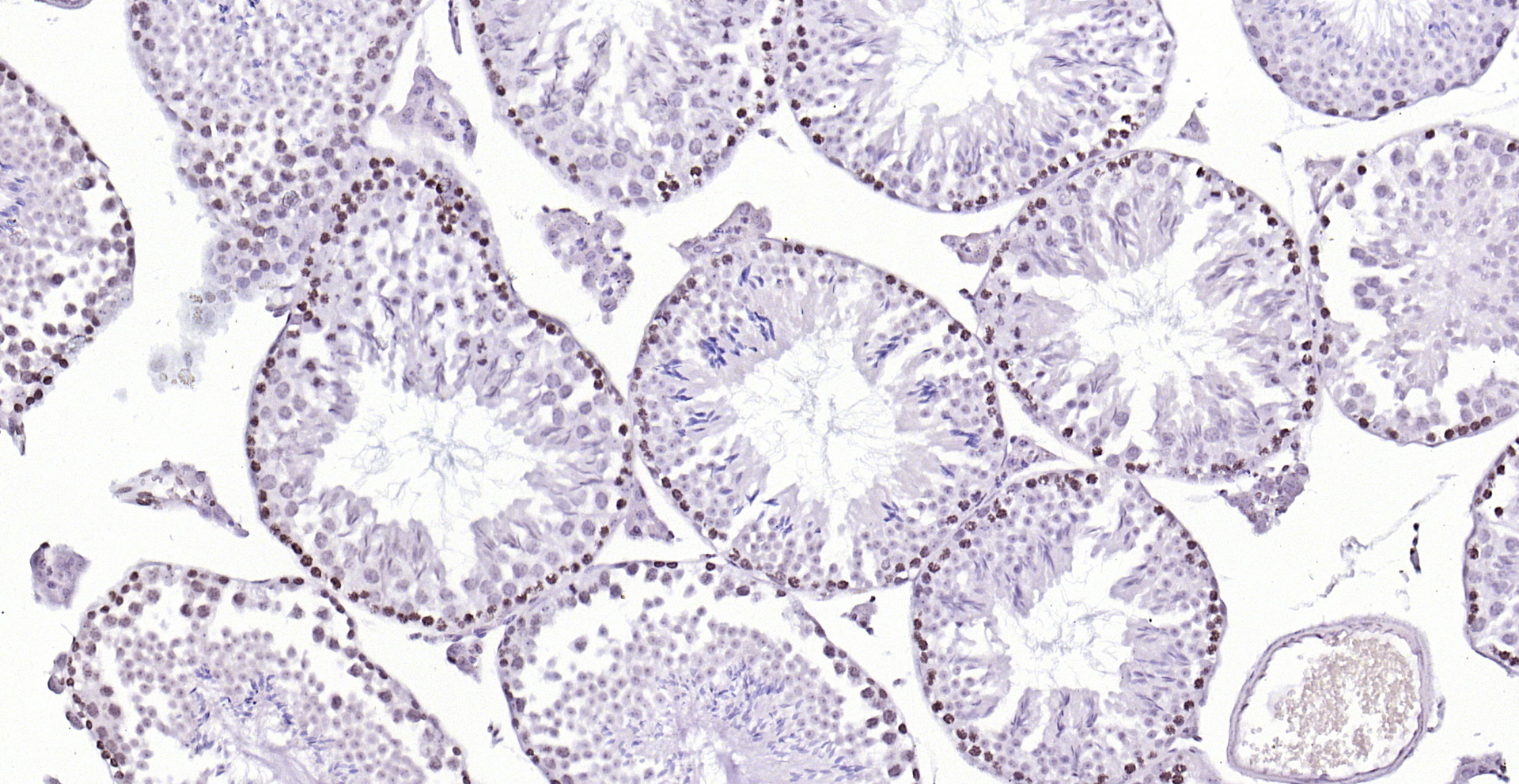 Paraformaldehyde-fixed, paraffin embedded (mouse testis); Antigen retrieval by boiling in sodium citrate buffer (pH6.0) for 15min; Block endogenous peroxidase by 3% hydrogen peroxide for 20 minutes; Blocking buffer (normal goat serum) at 37°C for 30min; Antibody incubation with (PEG3) Polyclonal Antibody, Unconjugated (bs-1870R) at 1:200 overnight at 4°C, followed by operating according to SP Kit(Rabbit) (sp-0023) instructionsand DAB staining.