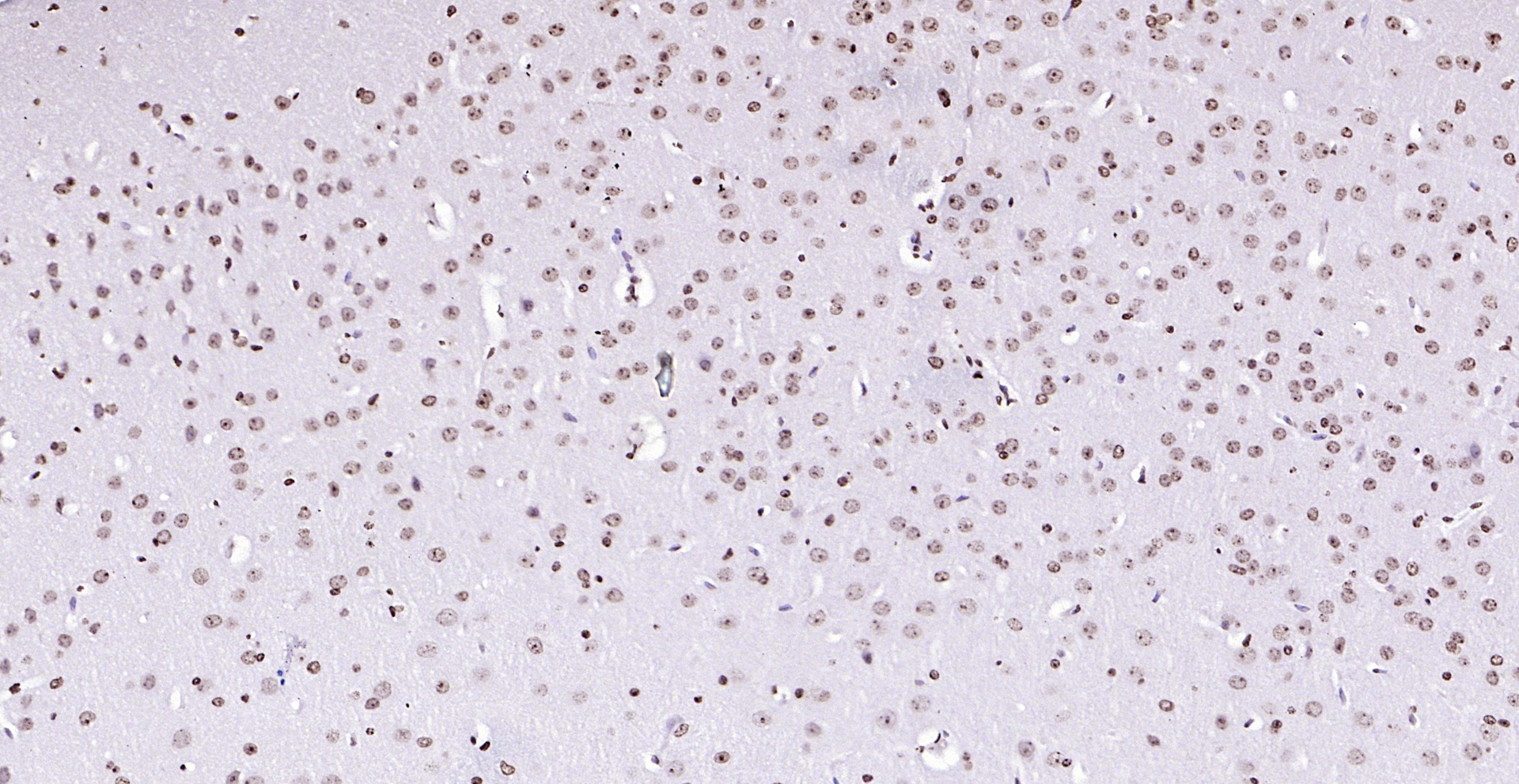 Paraformaldehyde-fixed, paraffin embedded (mouse brain); Antigen retrieval by boiling in sodium citrate buffer (pH6.0) for 15min; Block endogenous peroxidase by 3% hydrogen peroxide for 20 minutes; Blocking buffer (normal goat serum) at 37°C for 30min; Antibody incubation with (PEG3) Polyclonal Antibody, Unconjugated (bs-1870R) at 1:200 overnight at 4°C, followed by operating according to SP Kit(Rabbit) (sp-0023) instructionsand DAB staining.