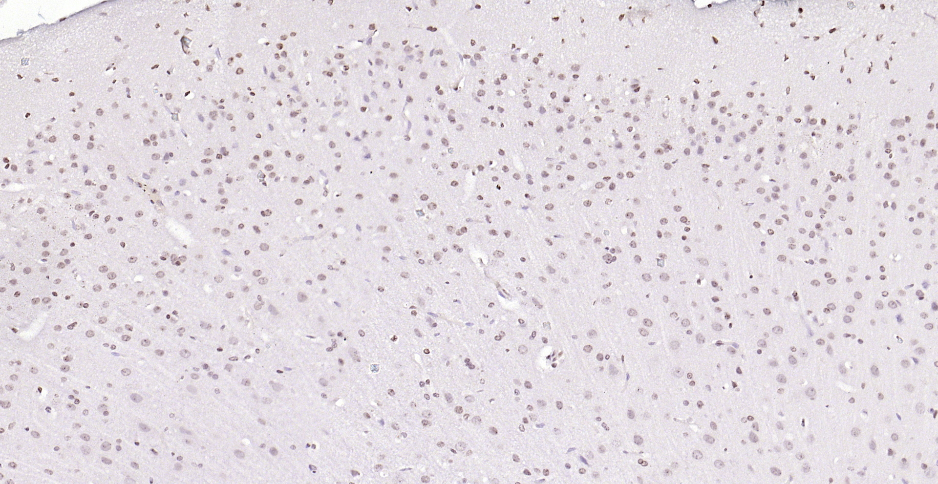 Paraformaldehyde-fixed, paraffin embedded (rat brain); Antigen retrieval by boiling in sodium citrate buffer (pH6.0) for 15min; Block endogenous peroxidase by 3% hydrogen peroxide for 20 minutes; Blocking buffer (normal goat serum) at 37°C for 30min; Antibody incubation with (PEG3) Polyclonal Antibody, Unconjugated (bs-1870R) at 1:200 overnight at 4°C, followed by operating according to SP Kit(Rabbit) (sp-0023) instructionsand DAB staining.