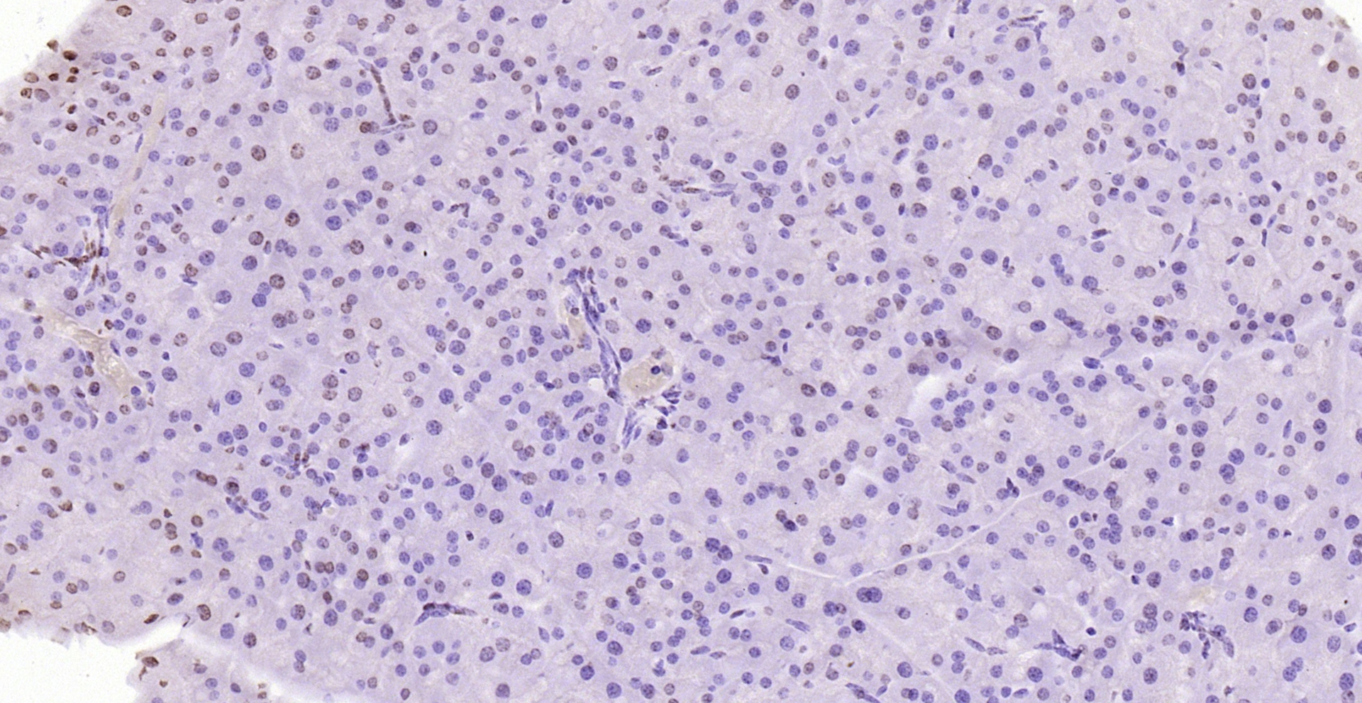 Paraformaldehyde-fixed, paraffin embedded (rat pancreas); Antigen retrieval by boiling in sodium citrate buffer (pH6.0) for 15min; Block endogenous peroxidase by 3% hydrogen peroxide for 20 minutes; Blocking buffer (normal goat serum) at 37°C for 30min; Antibody incubation with (PEG3) Polyclonal Antibody, Unconjugated (bs-1870R) at 1:200 overnight at 4°C, followed by operating according to SP Kit(Rabbit) (sp-0023) instructionsand DAB staining.
