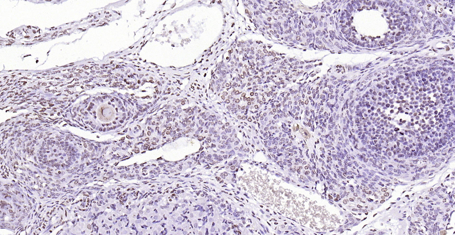 Paraformaldehyde-fixed, paraffin embedded (rat ovary); Antigen retrieval by boiling in sodium citrate buffer (pH6.0) for 15min; Block endogenous peroxidase by 3% hydrogen peroxide for 20 minutes; Blocking buffer (normal goat serum) at 37°C for 30min; Antibody incubation with (PEG3) Polyclonal Antibody, Unconjugated (bs-1870R) at 1:200 overnight at 4°C, followed by operating according to SP Kit(Rabbit) (sp-0023) instructionsand DAB staining.