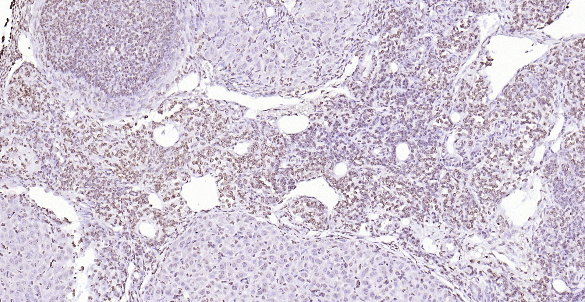 Paraformaldehyde-fixed, paraffin embedded (mouse ovary); Antigen retrieval by boiling in sodium citrate buffer (pH6.0) for 15min; Block endogenous peroxidase by 3% hydrogen peroxide for 20 minutes; Blocking buffer (normal goat serum) at 37°C for 30min; Antibody incubation with (PEG3) Polyclonal Antibody, Unconjugated (bs-1870R) at 1:200 overnight at 4°C, followed by operating according to SP Kit(Rabbit) (sp-0023) instructionsand DAB staining.