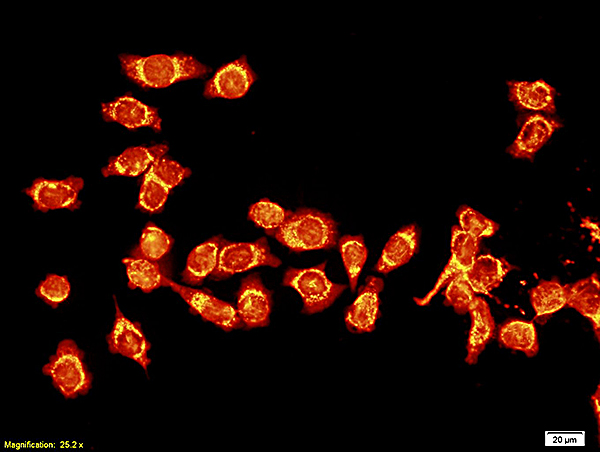 Formalin-fixed and paraffin embedded human tongue squamous carcinoma cells labeled with Anti-Lamin A, Unconjugated (bs-1839R) followed by conjugation to the secondary antibody