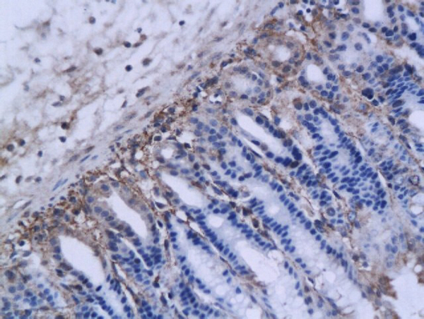 Formalin-fixed and paraffin embedded mouse ovarian tissue labeled with Anti-MMP-12, Unconjugated (bs-1854R) followed by conjugation to the secondary antibody