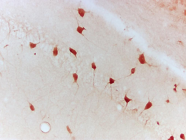 Mouse hippocampus labeled with Anti- Ntn1, Unconjugated (bs-1858R) followed by conjugation to the secondary antibody