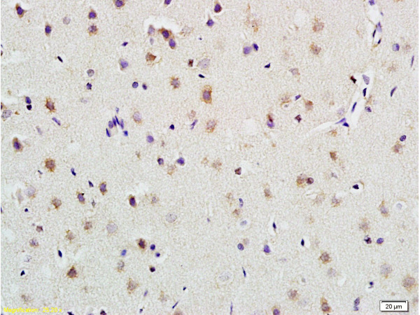 Formalin-fixed and paraffin embedded rat brain labeled with Anti-PLAUR Polyclonal Antibody, Unconjugated (bs-1927R) at 1:200 followed by conjugation to the secondary antibody and DAB staining