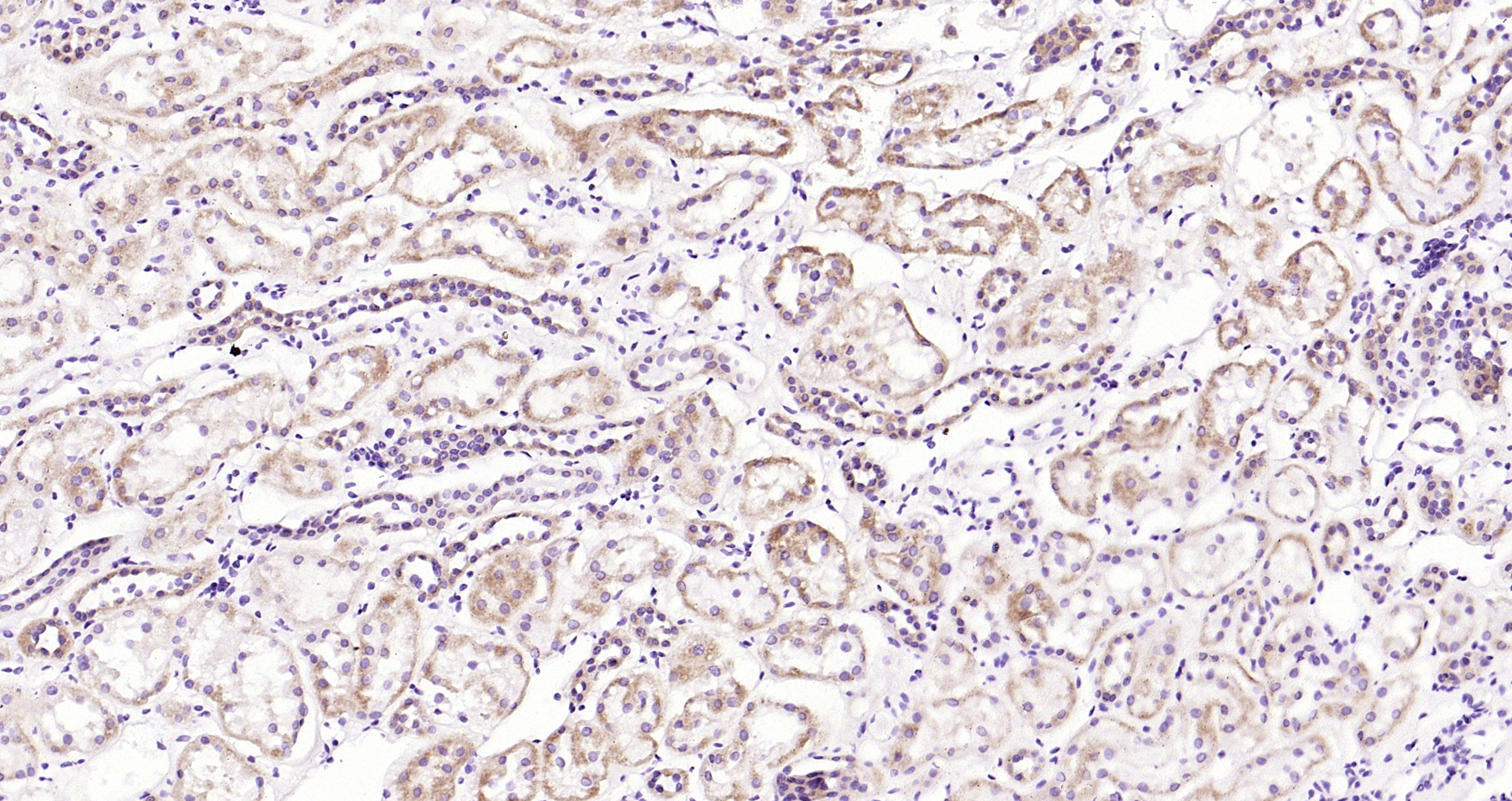 Paraformaldehyde-fixed, paraffin embedded (Human kidney); Antigen retrieval by boiling in sodium citrate buffer (pH6.0) for 15min; Block endogenous peroxidase by 3% hydrogen peroxide for 20 minutes; Blocking buffer (normal goat serum) at 37°C for 30min; Antibody incubation with (Cathepsin H) Polyclonal Antibody, Unconjugated (bs-1670R) at 1:200 overnight at 4°C, followed by operating according to SP Kit(Rabbit) (sp-0023) instructionsand DAB staining.