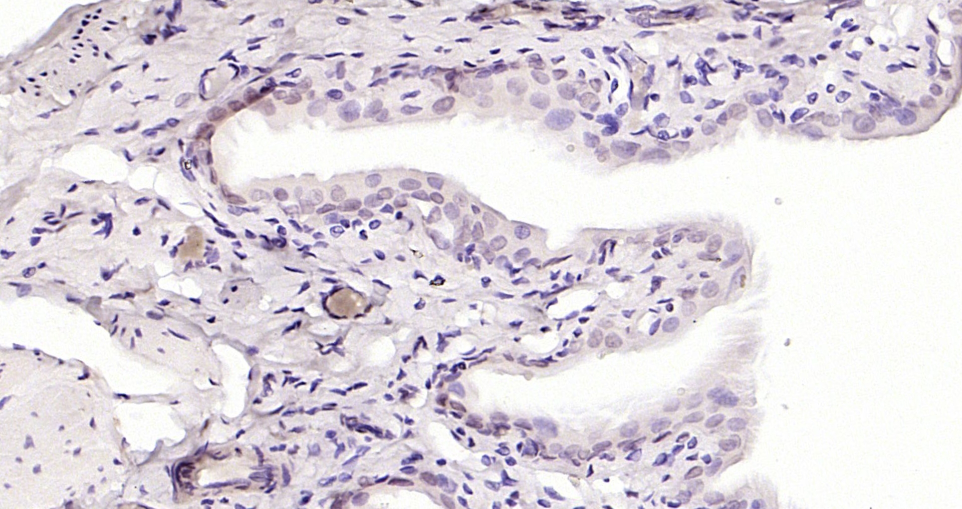 Paraformaldehyde-fixed, paraffin embedded (Rat bladder); Antigen retrieval by boiling in sodium citrate buffer (pH6.0) for 15min; Block endogenous peroxidase by 3% hydrogen peroxide for 20 minutes; Blocking buffer (normal goat serum) at 37°C for 30min; Antibody incubation with (GATA5) Polyclonal Antibody, Unconjugated (bs-1779R) at 1:200 overnight at 4°C, followed by operating according to SP Kit(Rabbit) (sp-0023) instructionsand DAB staining.