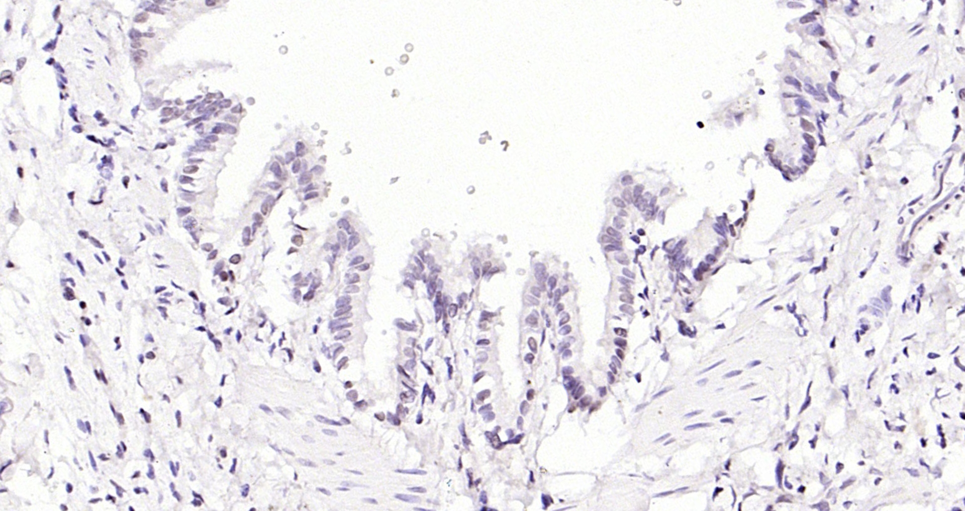 Paraformaldehyde-fixed, paraffin embedded (Rat lung); Antigen retrieval by boiling in sodium citrate buffer (pH6.0) for 15min; Block endogenous peroxidase by 3% hydrogen peroxide for 20 minutes; Blocking buffer (normal goat serum) at 37°C for 30min; Antibody incubation with (GATA5) Polyclonal Antibody, Unconjugated (bs-1779R) at 1:200 overnight at 4°C, followed by operating according to SP Kit(Rabbit) (sp-0023) instructionsand DAB staining.