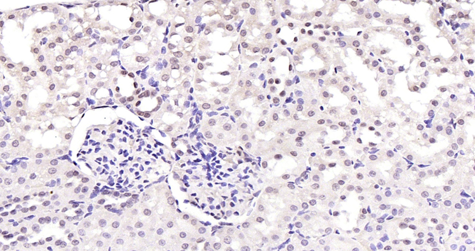 Paraformaldehyde-fixed, paraffin embedded (rat kidney); Antigen retrieval by boiling in sodium citrate buffer (pH6.0) for 15min; Block endogenous peroxidase by 3% hydrogen peroxide for 20 minutes; Blocking buffer (normal goat serum) at 37°C for 30min; Antibody incubation with (GATA5) Polyclonal Antibody, Unconjugated (bs-1779R) at 1:200 overnight at 4°C, followed by operating according to SP Kit(Rabbit) (sp-0023) instructionsand DAB staining.