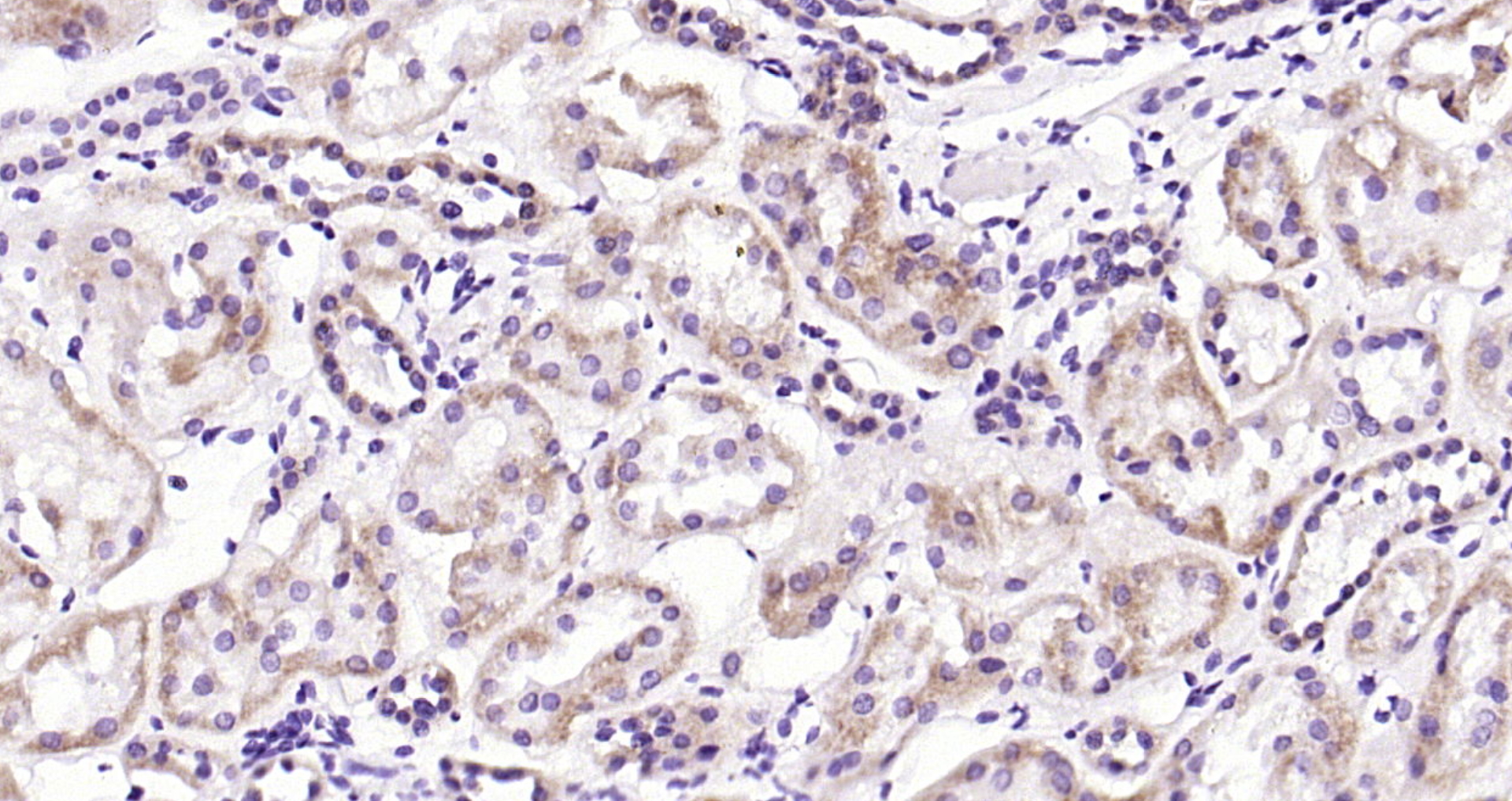 Paraformaldehyde-fixed, paraffin embedded (Human kidney); Antigen retrieval by boiling in sodium citrate buffer (pH6.0) for 15min; Block endogenous peroxidase by 3% hydrogen peroxide for 20 minutes; Blocking buffer (normal goat serum) at 37°C for 30min; Antibody incubation with (Iduronate 2 sulfatase) Polyclonal Antibody, Unconjugated (bs-15543R) at 1:200 overnight at 4°C, followed by operating according to SP Kit(Rabbit) (sp-0023) instructionsand DAB staining.