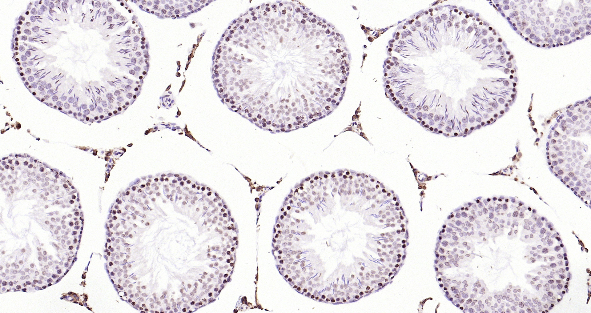 Paraformaldehyde-fixed, paraffin embedded (rat testis); Antigen retrieval by boiling in sodium citrate buffer (pH6.0) for 15min; Block endogenous peroxidase by 3% hydrogen peroxide for 20 minutes; Blocking buffer (normal goat serum) at 37°C for 30min; Antibody incubation with (Pan-Histone H3.1) Polyclonal Antibody, Unconjugated (bs-17422R) at 1:200 overnight at 4°C, followed by operating according to SP Kit(Rabbit) (sp-0023) instructionsand DAB staining. Paraformaldehyde-fixed, paraffin embedded (rat testis); Antigen retrieval by boiling in sodium citrate buffer (pH6.0) for 15min; Block endogenous peroxidase by 3% hydrogen peroxide for 20 minutes; Blocking buffer (normal goat serum) at 37°C for 30min; Antibody incubation with (Pan-Histone H3.1) Polyclonal Antibody, Unconjugated (bs-17422R) at 1:200 overnight at 4°C, followed by operating according to SP Kit(Rabbit) (sp-0023) instructionsand DAB staining.