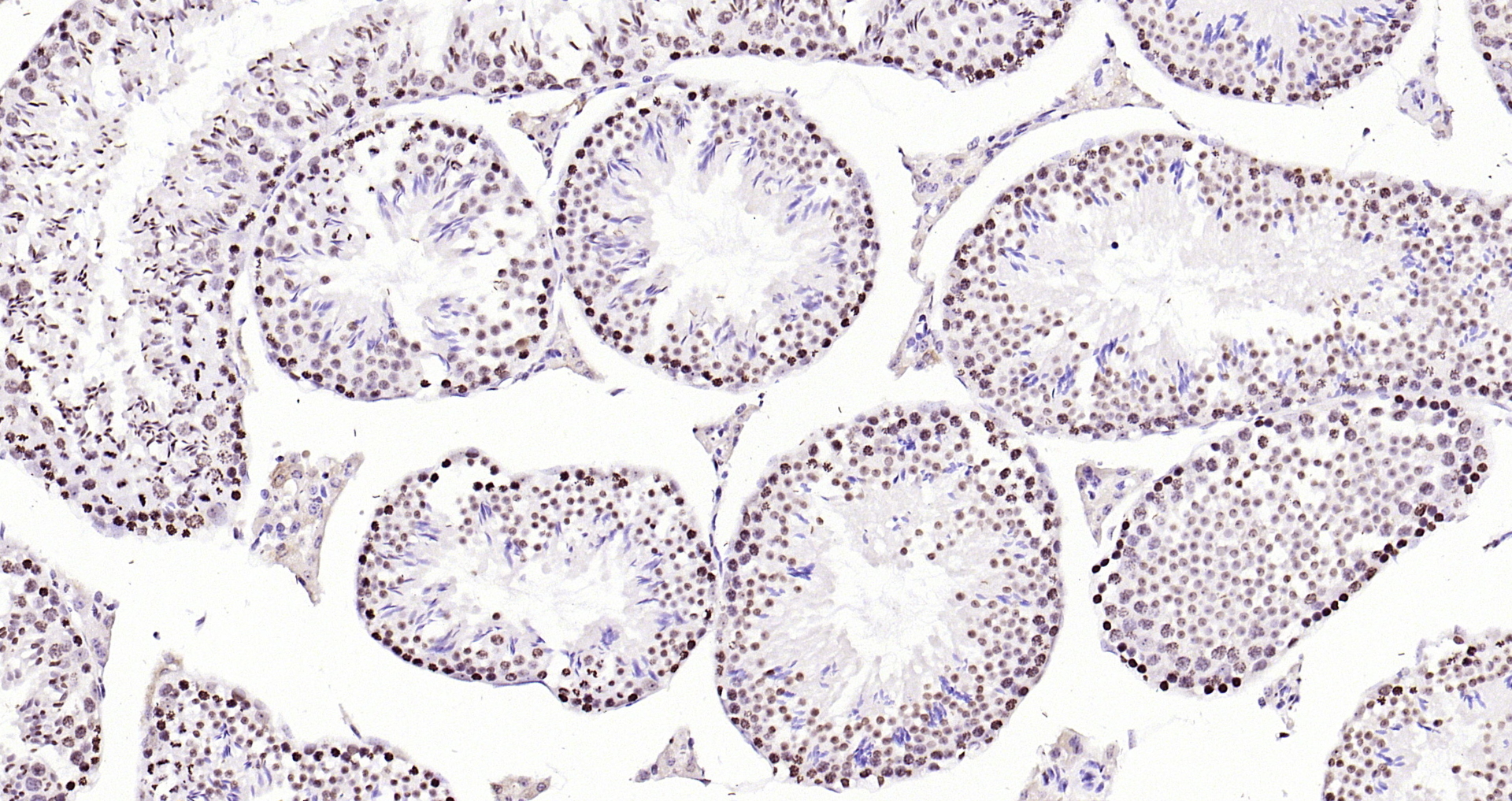 Paraformaldehyde-fixed, paraffin embedded (mouse testis); Antigen retrieval by boiling in sodium citrate buffer (pH6.0) for 15min; Block endogenous peroxidase by 3% hydrogen peroxide for 20 minutes; Blocking buffer (normal goat serum) at 37°C for 30min; Antibody incubation with (Pan-Histone H3.1) Polyclonal Antibody, Unconjugated (bs-17422R) at 1:200 overnight at 4°C, followed by operating according to SP Kit(Rabbit) (sp-0023) instructionsand DAB staining. Paraformaldehyde-fixed, paraffin embedded (mouse testis); Antigen retrieval by boiling in sodium citrate buffer (pH6.0) for 15min; Block endogenous peroxidase by 3% hydrogen peroxide for 20 minutes; Blocking buffer (normal goat serum) at 37°C for 30min; Antibody incubation with (Pan-Histone H3.1) Polyclonal Antibody, Unconjugated (bs-17422R) at 1:200 overnight at 4°C, followed by operating according to SP Kit(Rabbit) (sp-0023) instructionsand DAB staining.