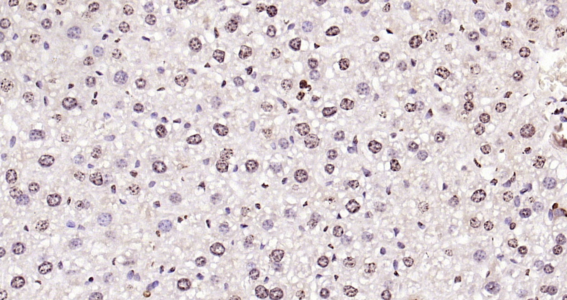 Paraformaldehyde-fixed, paraffin embedded (mouse liver); Antigen retrieval by boiling in sodium citrate buffer (pH6.0) for 15min; Block endogenous peroxidase by 3% hydrogen peroxide for 20 minutes; Blocking buffer (normal goat serum) at 37°C for 30min; Antibody incubation with (Pan-Histone H3.1) Polyclonal Antibody, Unconjugated (bs-17422R) at 1:200 overnight at 4°C, followed by operating according to SP Kit(Rabbit) (sp-0023) instructionsand DAB staining. Paraformaldehyde-fixed, paraffin embedded (mouse liver); Antigen retrieval by boiling in sodium citrate buffer (pH6.0) for 15min; Block endogenous peroxidase by 3% hydrogen peroxide for 20 minutes; Blocking buffer (normal goat serum) at 37°C for 30min; Antibody incubation with (Pan-Histone H3.1) Polyclonal Antibody, Unconjugated (bs-17422R) at 1:200 overnight at 4°C, followed by operating according to SP Kit(Rabbit) (sp-0023) instructionsand DAB staining.
