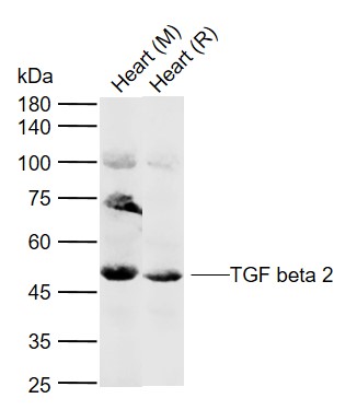 Lane 1: Mouse Heart tissue lysates; Lane 2: Rat Heart tissue lysates probed with TGF beta 2 Polyclonal Antibody, Unconjugated (bs-20412R) at 1:1000 dilution and 4°C overnight incubation. Followed by conjugated secondary antibody incubation at 1:20000 for 60 min at 37˚C.