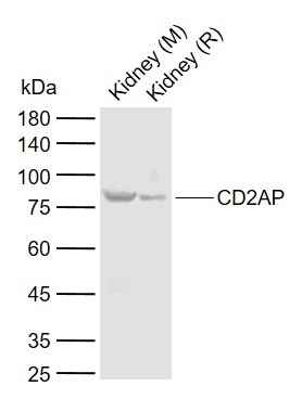Lane 1: Mouse Kidney tissue lysates; Lane 2: Rat Kidney tissue lysates probed with CD2AP Polyclonal Antibody, Unconjugated (bs-0512R) at 1:1000 dilution and 4°C overnight incubation. Followed by conjugated secondary antibody incubation at 1:20000 for 60 min at 37˚C.