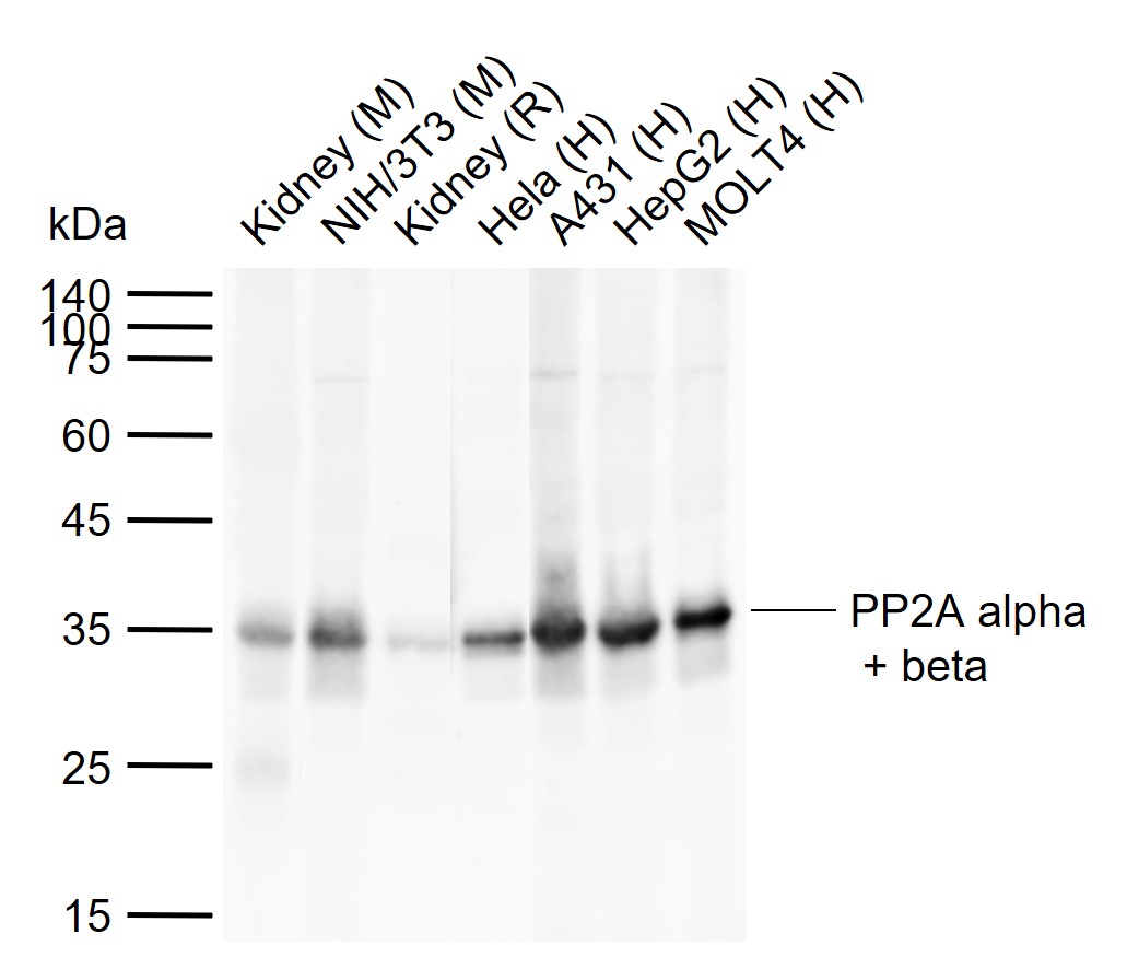 Lane 1: Mouse Kidney tissue lysates; Lane 2: Mouse NIH/3T3 cell lysates; Lane 3: Rat Kidney tissue lysates; Lane 4: Human Hela cell lysates; Lane 5: Human A431 cell lysates; Lane 6: Human HepG2 cell lysates; Lane 7: Human MOLT4 cell lysates probed with PP2A alpha + beta Polyclonal Antibody, Unconjugated (bs-0029R) at 1:1000 dilution and 4°C overnight incubation. Followed by conjugated secondary antibody incubation at 1:20000 for 60 min at 37˚C.