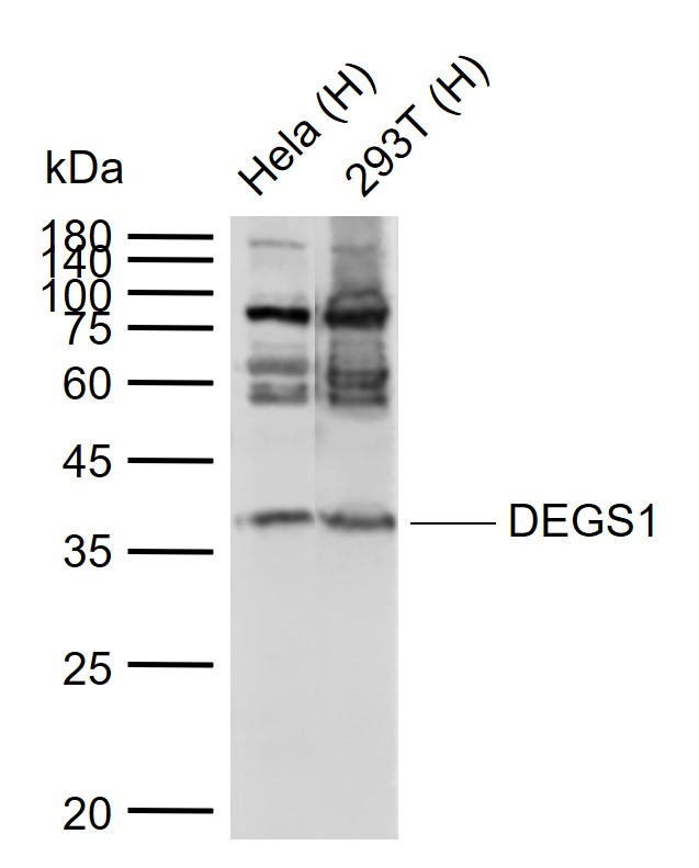Lane 1: Human Hela cell lysates; Lane 2: Human 293T cell lysates probed with DEGS1 Polyclonal Antibody, Unconjugated (bs-4057R) at 1:1000 dilution and 4°C overnight incubation. Followed by conjugated secondary antibody incubation at 1:20000 for 60 min at 37˚C.