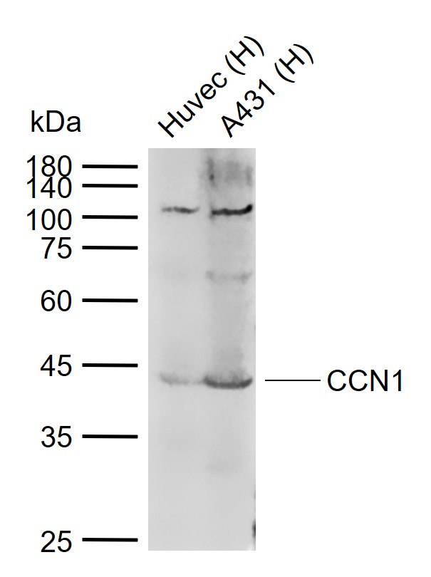 Lane 1: Human Huvec cell lysates; Lane 2: Human A431 cell lysates probed with CCN1/Cyr61 Polyclonal Antibody, Unconjugated (bs-1290R) at 1:1000 dilution and 4°C overnight incubation. Followed by conjugated secondary antibody incubation at 1:20000 for 60 min at 37˚C.
