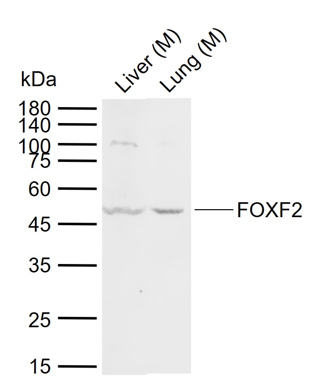Lane 1: Mouse Liver tissue lysates; Lane 2: Mouse Lung tissue lysates probed with FOXF2 Polyclonal Antibody, Unconjugated (bs-13201R) at 1:1000 dilution and 4°C overnight incubation. Followed by conjugated secondary antibody incubation at 1:20000 for 60 min at 37˚C.