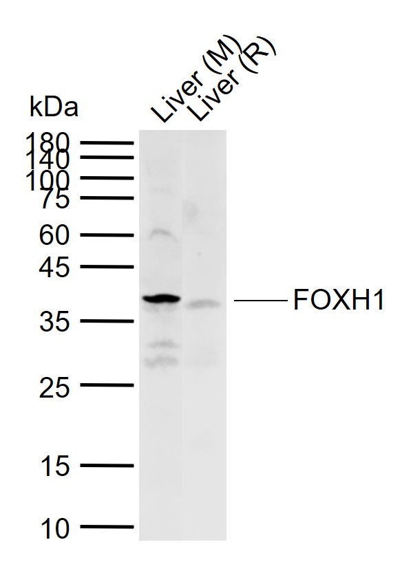 Lane 1: Mouse Liver tissue lysates; Lane 2: Rat Liver tissue lysates probed with FOXH1 Polyclonal Antibody, Unconjugated (bs-13202R) at 1:1000 dilution and 4°C overnight incubation. Followed by conjugated secondary antibody incubation at 1:20000 for 60 min at 37˚C.