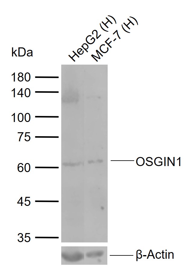 Lane 1: Human HepG2 cell lysates; Lane 2: Human MCF-7 cell lysates probed with OSGIN1 Polyclonal Antibody, Unconjugated (bs-5723R) at 1:1000 dilution and 4°C overnight incubation. Followed by conjugated secondary antibody incubation at 1:20000 for 60 min at 37˚C.