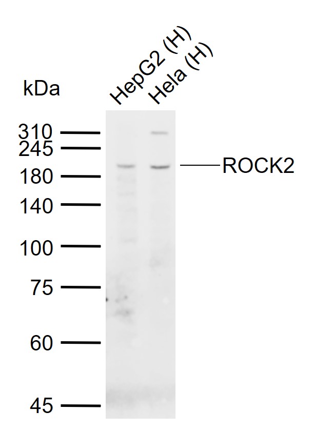 Lane 1: Human HepG2 cell lysates; Lane 2: Human Hela cell lysates probed with ROCK2 Monoclonal Antibody, Unconjugated (bsm-60013M) at 1:1000 dilution and 4\u00b0C overnight incubation. Followed by conjugated secondary antibody incubation at 1:20000 for 60 min at 37˚C.