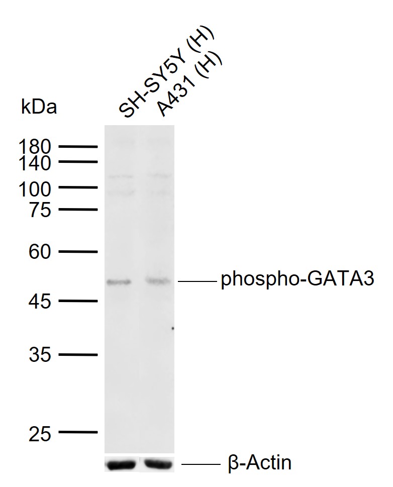 Lane 1: Human SH-SY5Y cell lysates; Lane 2: Human A431 cell lysates probed with phospho-GATA3 (Ser308) Polyclonal Antibody, Unconjugated (bs-13294R) at 1:1000 dilution and 4°C overnight incubation. Followed by conjugated secondary antibody incubation at 1:20000 for 60 min at 37˚C.