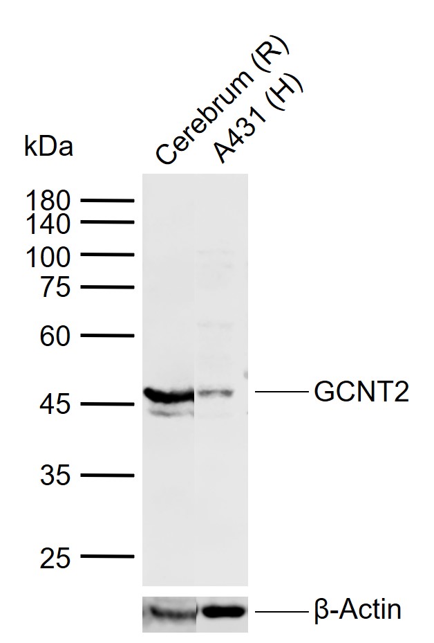 Lane 1: Rat Cerebrum tissue lysates; Lane 2: Human A431 cell lysates probed with GCNT2 Polyclonal Antibody, Unconjugated (bs-13316R) at 1:1000 dilution and 4°C overnight incubation. Followed by conjugated secondary antibody incubation at 1:20000 for 60 min at 37˚C.